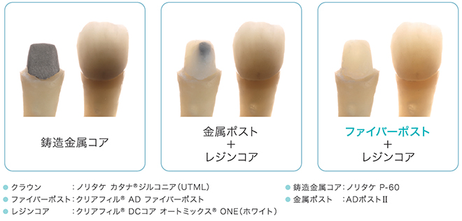 鋳造金属コア　金属ポスト＋レジンコア　ファイバーポスト＋レジンコア　・クラウン：ノリタケ カタナ® ジルコニア(UTML)　・ファイバーポスト：クリアフィル® AD ファイバーポスト　・レジンコア：クリアフィル® DCコア オートミックス® ONE（ホワイト）　・鋳造金属コア：ノリタケ P-60　・金属ポスト：ADポストⅡ