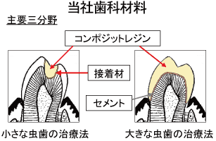 * 審美修復：自然で美しい歯の外観を再現する修復治療