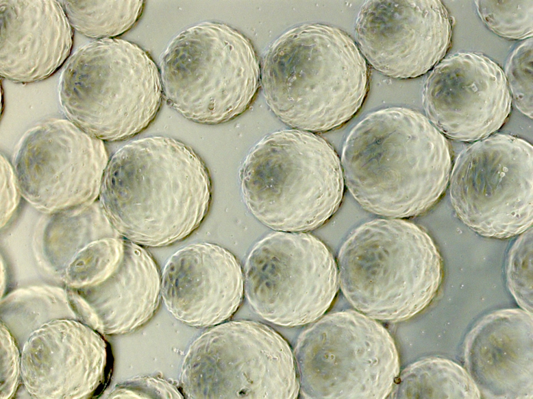〈PVAハイドロゲルマイクロキャリア上の培養細胞の顕微鏡画像